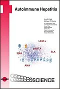 E-Book (pdf) Autoimmune Hepatitis von Arndt Vogel, Michael P. Manns