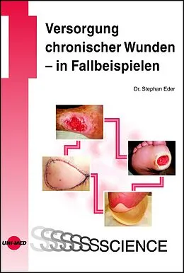 E-Book (pdf) Versorgung chronischer Wunden - in Fallbeispielen von Stephan Eder