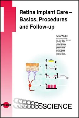 E-Book (pdf) Retina Implant Care - Basics, Procedures and Follow-up von Peter Walter