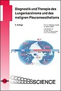 E-Book (pdf) Diagnostik und Therapie des Lungenkarzinoms und des malignen Pleuramesothelioms von Wolfgang Schütte, Miriam Möller