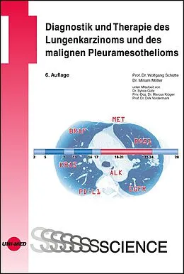 E-Book (pdf) Diagnostik und Therapie des Lungenkarzinoms und des malignen Pleuramesothelioms von Wolfgang Schütte, Miriam Möller
