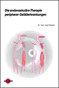 E-Book (pdf) Die endovaskuläre Therapie peripherer Gefäßerkrankungen von Jörg Teßarek
