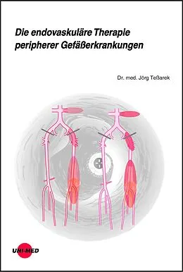 E-Book (pdf) Die endovaskuläre Therapie peripherer Gefäßerkrankungen von Jörg Teßarek