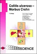 E-Book (pdf) Colitis ulcerosa - Morbus Crohn von Klaus R. Herrlinger, Eduard F. Stange