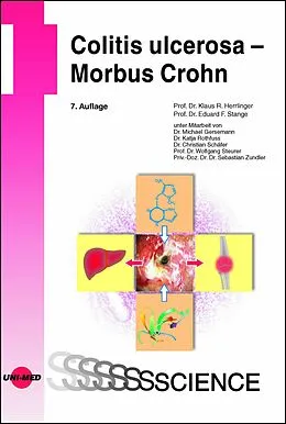 E-Book (pdf) Colitis ulcerosa - Morbus Crohn von Klaus R. Herrlinger, Eduard F. Stange