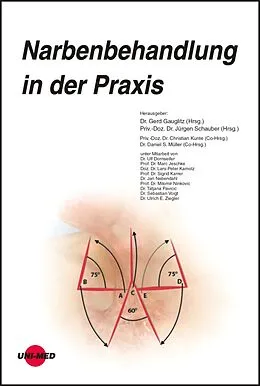 E-Book (pdf) Narbenbehandlung in der Praxis von Gerd Gauglitz, Jürgen Schauber