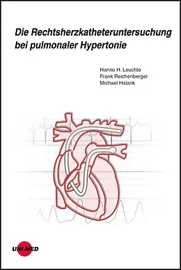 E-Book (pdf) Die Rechtsherzkatheteruntersuchung bei pulmonaler Hypertonie von Hanno H. Leuchte, Frank Reichenberger, Michael Halank