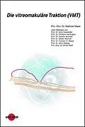 E-Book (pdf) Die vitreomakuläre Traktion (VMT) von Mathias Maier