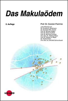 E-Book (pdf) Das Makulaödem von Carsten Framme