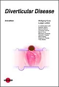 E-Book (pdf) Diverticular Disease von Wolfgang Kruis, Ludger Leifeld