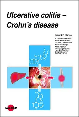 E-Book (pdf) Ulcerative colitis - Crohn's disease von Eduard F. Stange