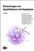 E-Book (pdf) Erkrankungen von Hypothalamus und Hypophyse von Stephan Petersenn