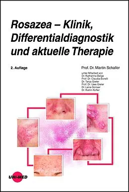 E-Book (pdf) Rosazea - Klinik, Differentialdiagnostik und aktuelle Therapie von Martin Schaller