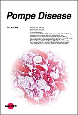 E-Book (pdf) Pompe Disease von Arnold J. J. Reuser, Benedikt Schoser