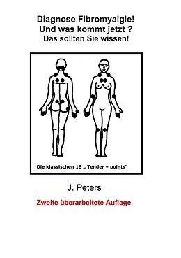 E-Book (epub) Diagnose Fibromyalgie! Und was kommt jetzt? von Joachim Peters
