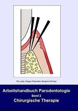 E-Book (epub) Arbeitshandbuch Parodontologie von Tim Joda, Gregor Petersilka, Benjamin Ehmke