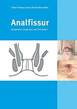 E-Book (epub) Analfissur von Franz Raulf, Prof. Dr. med. Volker Wienert, Dr. med. Horst Mlitz