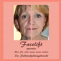 E-Book (epub) Facelift operativ von Bernhard Siegmund, Ute Fischer