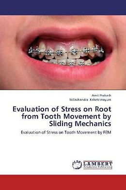 Couverture cartonnée Evaluation of Stress on Root from Tooth Movement by Sliding Mechanics de Amit Prakash, Nillachandra Kshetrimayum