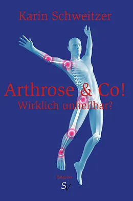 E-Book (epub) Arthrose &amp; Co - Wirklich unheilbar? von Karin Schweitzer