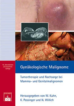 E-Book (epub) Gynäkologische Malignome von W. Kuhn, K. Possinger, N. Willich