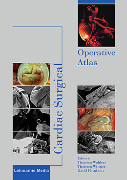 eBook (pdf) Cardiac Surgical Operative Atlas de 