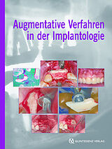 E-Book (epub) Augmentative Verfahren in der Implantologie von Fouad Khoury
