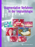 E-Book (epub) Augmentative Verfahren in der Implantologie von Fouad Khoury