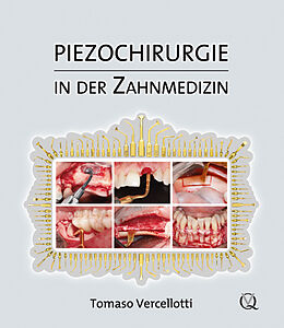 Fester Einband Piezochirurgie in der Zahnmedizin von Tomaso Vercellotti