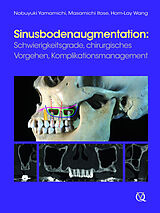 E-Book (epub) Sinusbodenaugmentation von Nobuyuki Yamamichi, Masamichi Itose, Hom-Lay Wang