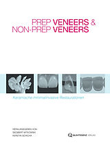 E-Book (epub) Prep Veneers und Non-Prep Veneers von Siegbert Witkowski, Kerstin Schicha