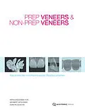 E-Book (epub) Prep Veneers und Non-Prep Veneers von Siegbert Witkowski, Kerstin Schicha