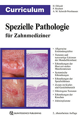 Kartonierter Einband Curriculum Spezielle Pathologie für Zahnmediziner von Harald Ebhardt, Peter A. Reichart, Andrea Maria Schmidt-Westhausen