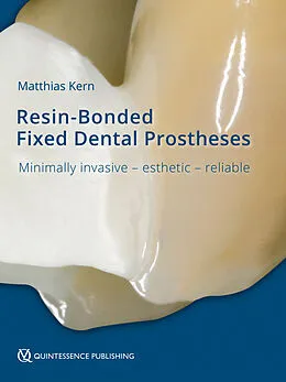 E-Book (epub) Resin-Bonded Fixed Dental Prostheses von Matthias Kern