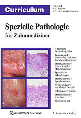 E-Book (epub) Curriculum Spezielle Pathologie für Zahnmediziner von Harald Ebhardt, Peter A. Reichart, Andrea Maria Schmidt-Westhausen
