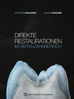 E-Book (epub) Direkte Restaurationen im Seitenzahnbereich von Salvatore Scolavino, Gaetano Paolone