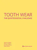 E-Book (epub) Tooth Wear von Débora R. Vilaboa, Beatriz R. Vilaboa, Jose Manuel Reuss