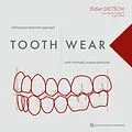 E-Book (pdf) Tooth Wear von Didier Dietschi, Carlo Massimo Saratti, Serge Erpen