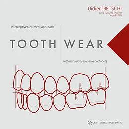 E-Book (pdf) Tooth Wear von Didier Dietschi, Carlo Massimo Saratti, Serge Erpen
