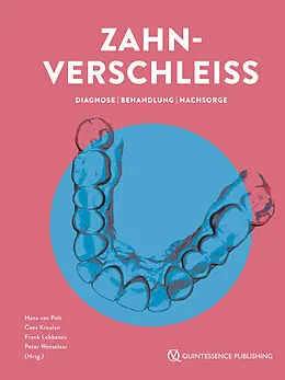 E-Book (epub) Zahnverschleiß von Hans van Pelt, Cees Kreulen, Frank Lobbezoo
