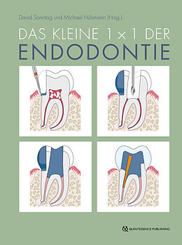 E-Book (pdf) Das kleine 1x1 der Endodontie von 