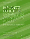 E-Book (pdf) Implantatprothetik von Stefan Wolfart