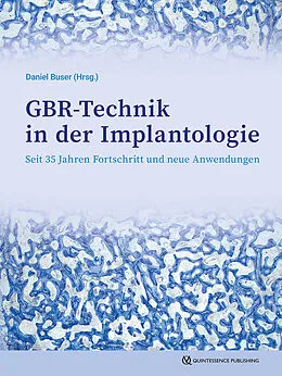 E-Book (epub) GBR-Technik in der Implantologie von 
