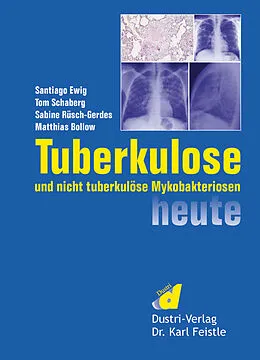 E-Book (pdf) Tuberkulose und nicht tuberkulöse Mykobakteriosen heute von Santiago Ewig, Tom Schaberg, Sabine Rüsch-Gerdes