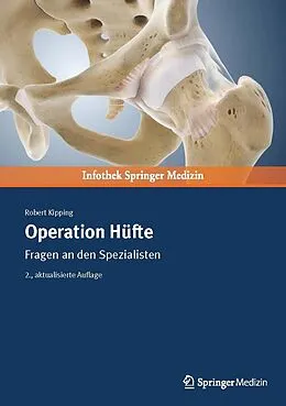 E-Book (pdf) Operation Hüfte von Robert Kipping