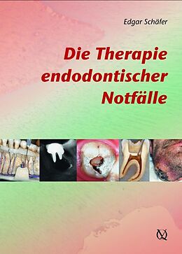 Fester Einband Die Therapie endodontischer Notfälle von Edgar Schäfer