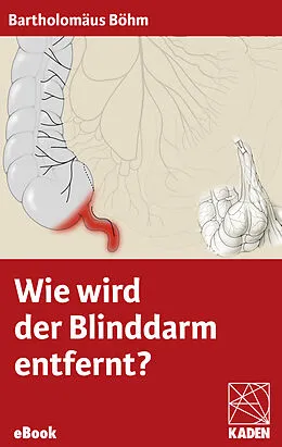 E-Book (epub) Wie wird der Blinddarm entfernt? von Bartholomäus Böhm