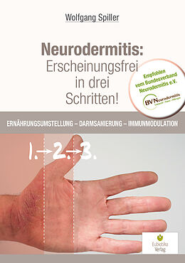 Kartonierter Einband Neurodermitis: Erscheinungsfrei in drei Schritten! von Spiller Wolfgang