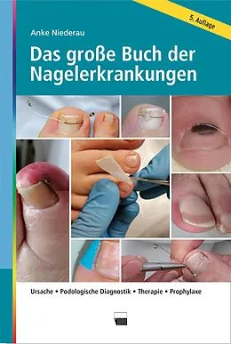 E-Book (epub) Das große Buch der Nagelerkrankungen von Anke Niederau