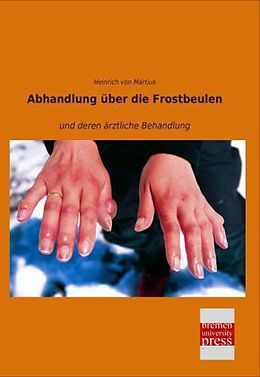Kartonierter Einband Abhandlung über die Frostbeulen von Heinrich Von Martius